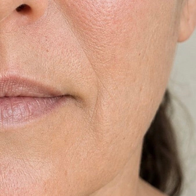 Noctis Night Deep Cleanser — Week 12