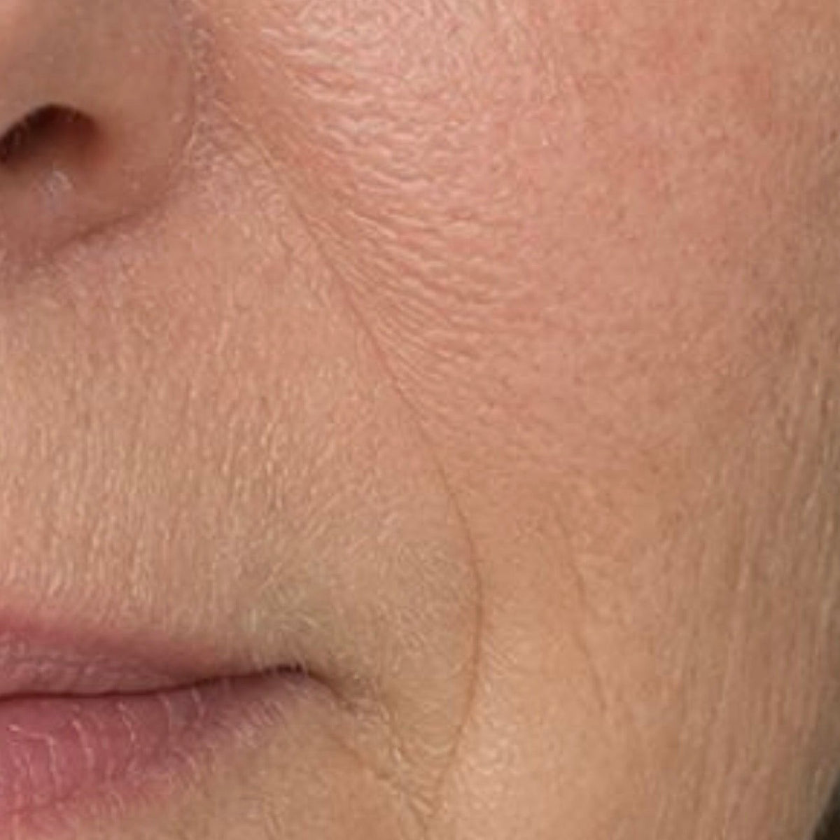 Ionis Toning Mist — Week 0