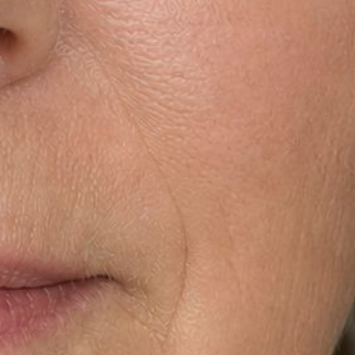 Ionis Toning Mist — Week 12