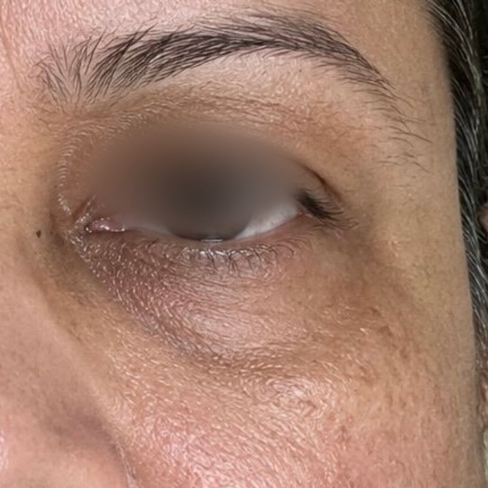 Noctis Longevity Night Cream — Week 0