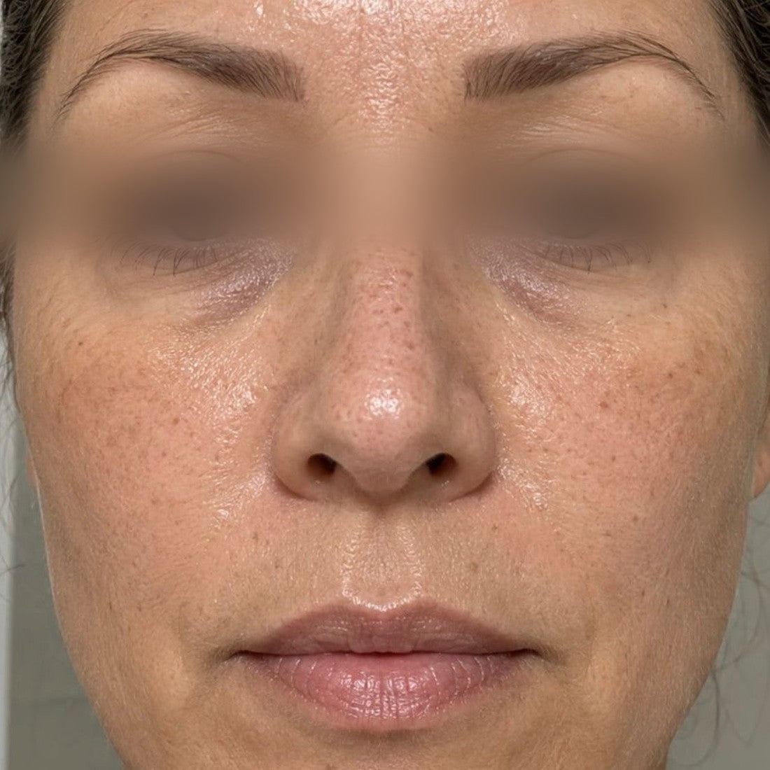 Noctis Longevity Night Serum — Week 0