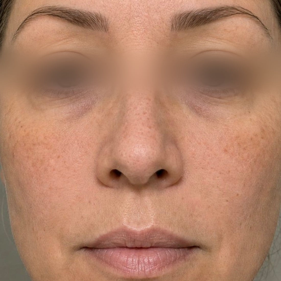 Noctis Longevity Night Serum — Week 12