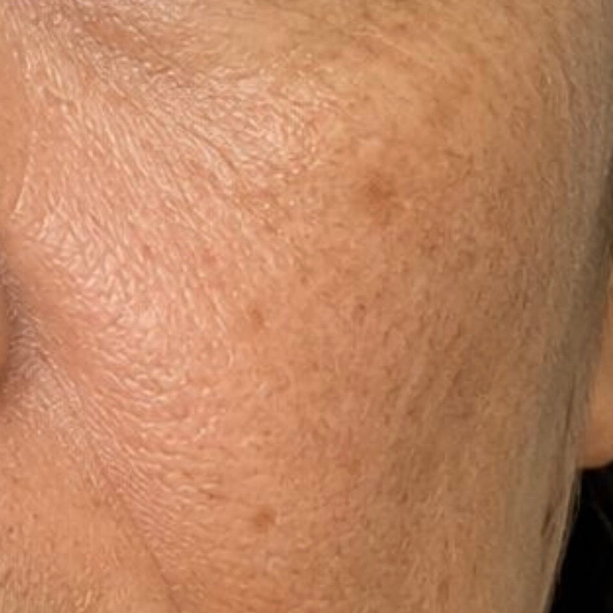 Photogena Facial Treatment Cleanser — Week 0