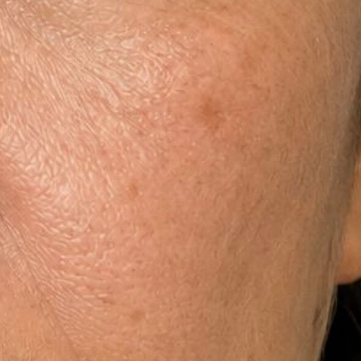 Photogena Facial Treatment Cleanser — Week 12