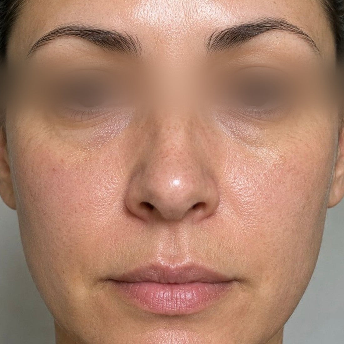 Photogena Facial Treatment Cleanser — Week 0