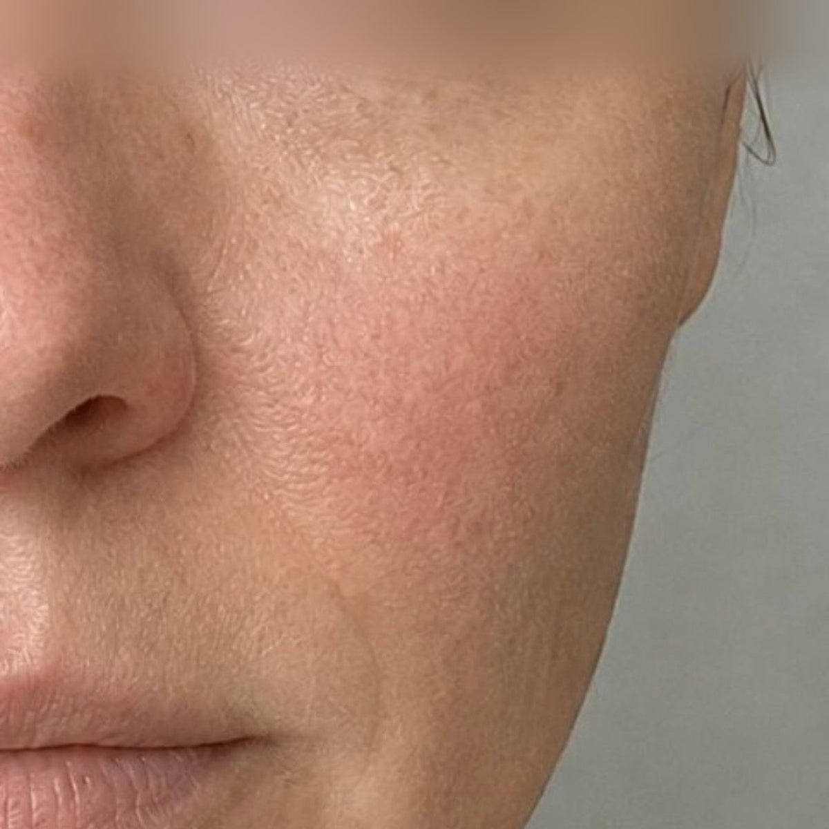 Profunda The Treatment Mask — Week 12