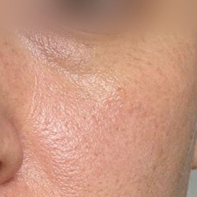Renova The Eye Cream — Week 0